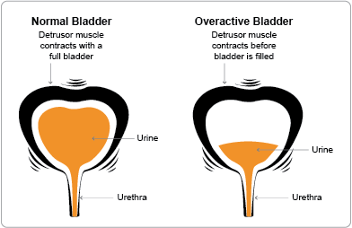 Symptoms of low testosterone in women