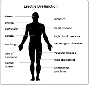 Erectile Dysfunction Overview